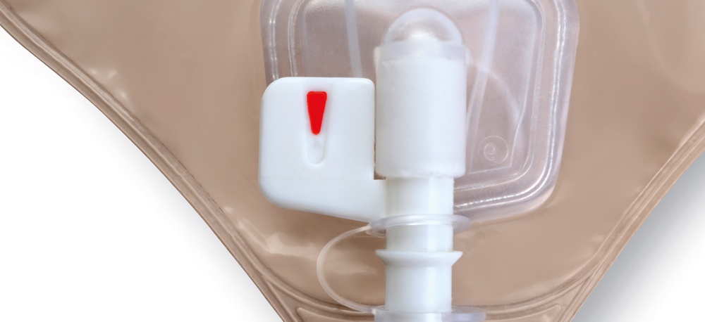 Esteem Synergy Versorgungswechsel &ndash; Schritt 14