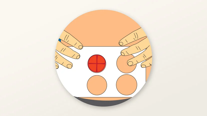 Απεικόνιση του τρόπου μέτρησης μιας στομίας