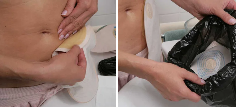 Die sechs Schritte des Versorgungswechsels –  Schritt 2 Bild