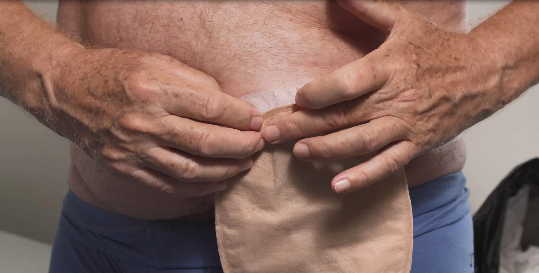 konvexni-tvarovatelna-natura